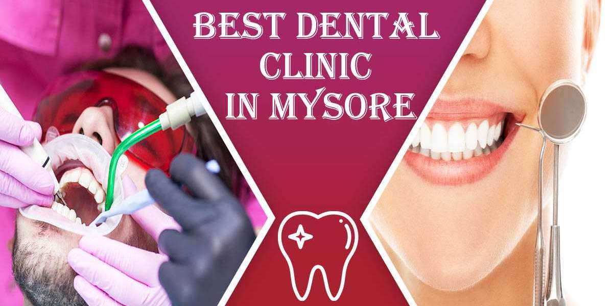 Best Dental Clinic in Mysore