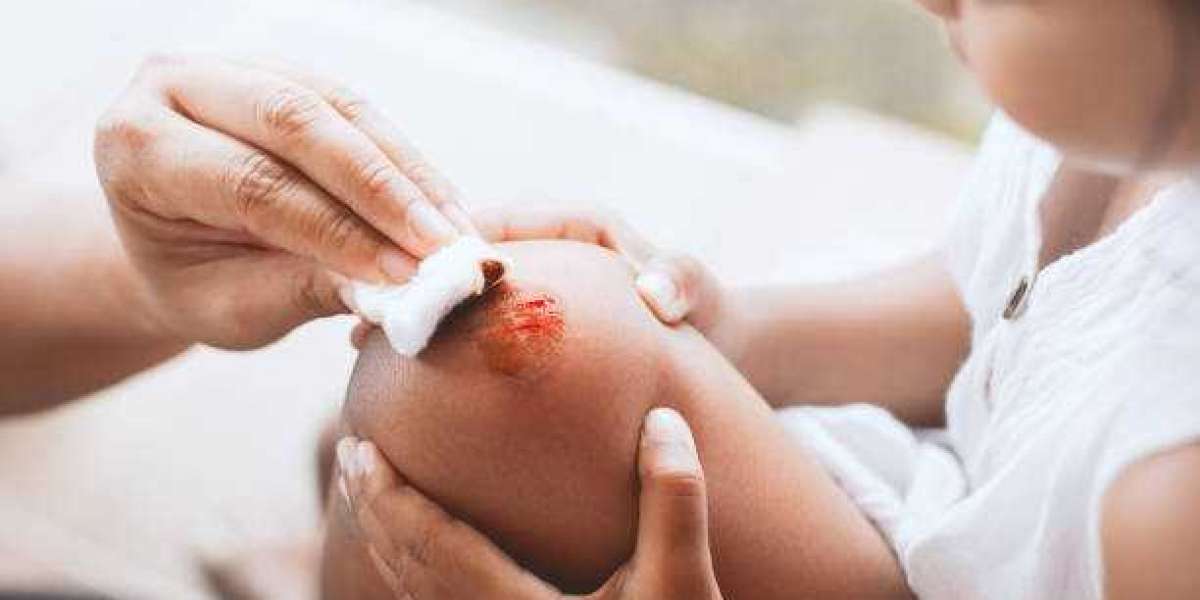 Healing Wounds Naturally: Harnessing the Power of Essential Oils for Wound Healing