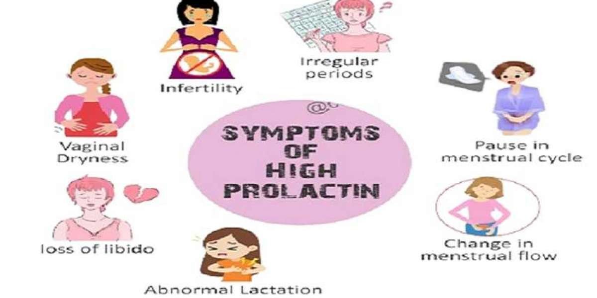 Often Held Myths Regarding Hyperprolactinemia