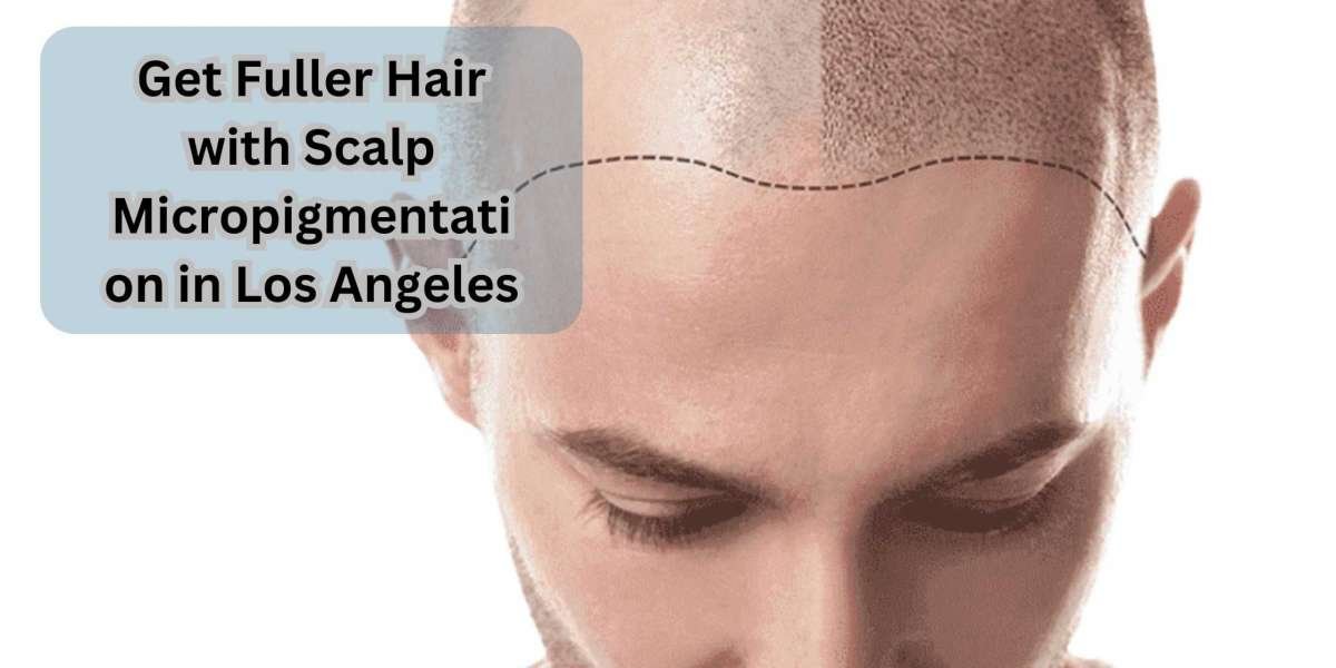 Get Fuller Hair with Scalp Micropigmentation in Los Angeles