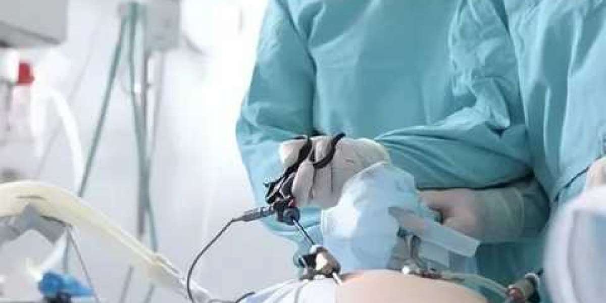 Hernia Surgery: A Safe and Effective Solution for Hernia Relief