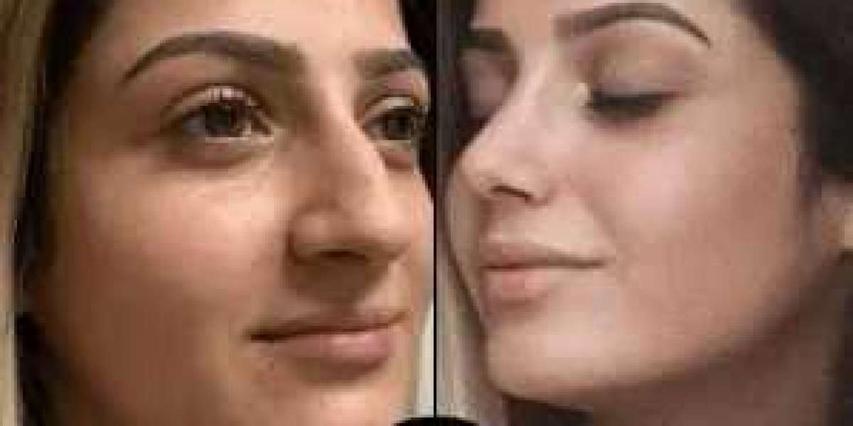 Best Plastic Surgeon in Dubai for Flawless Results
