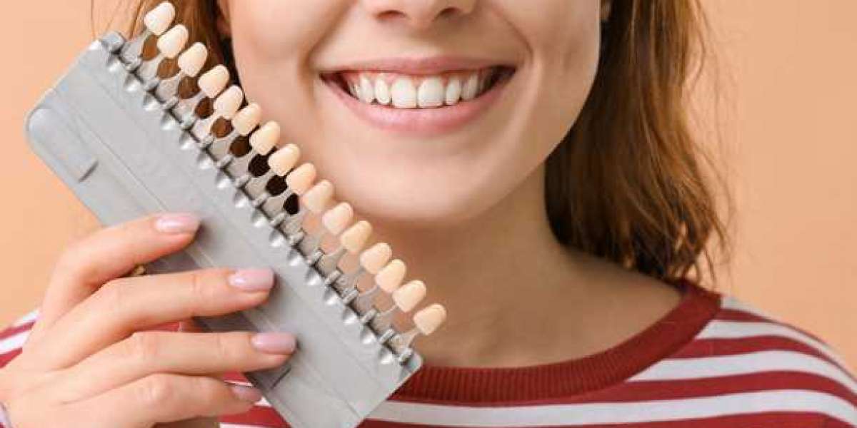 Painless, Natural Smile Makeover with Lumineers in Dubai