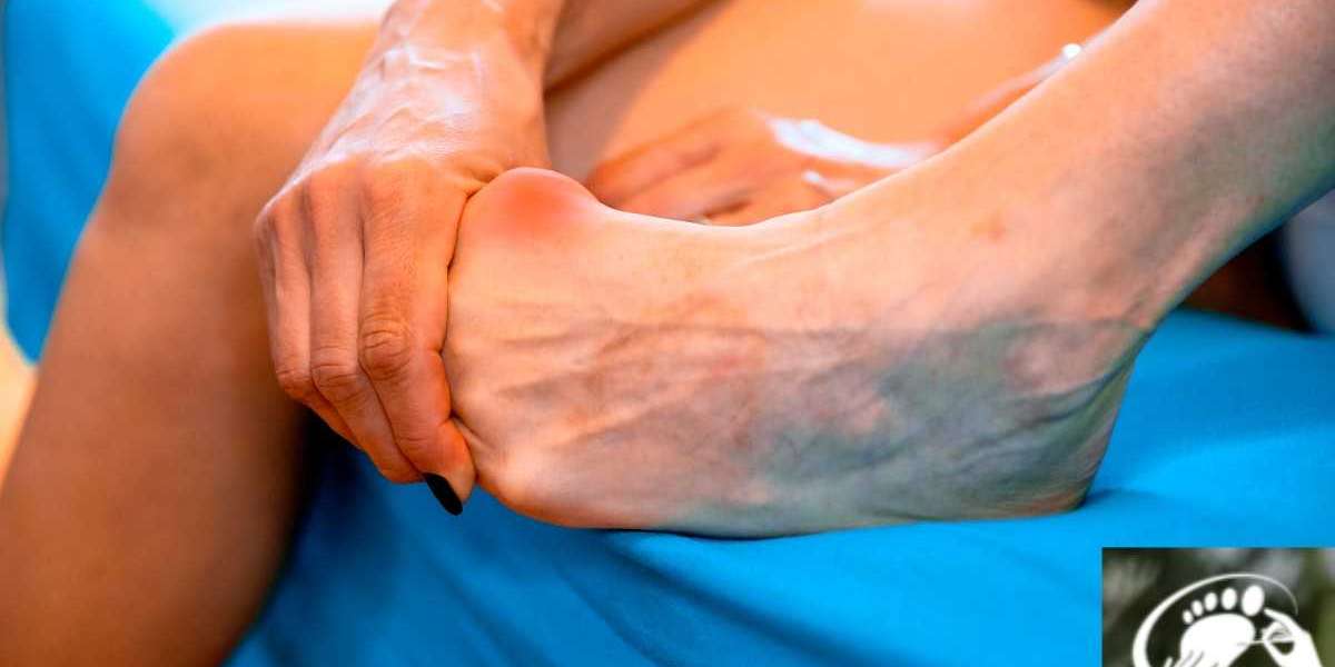 Plantar Fasciitis Treatment in the UK: Effective Ways to Relieve Heel Pain and Walk Comfortably Again