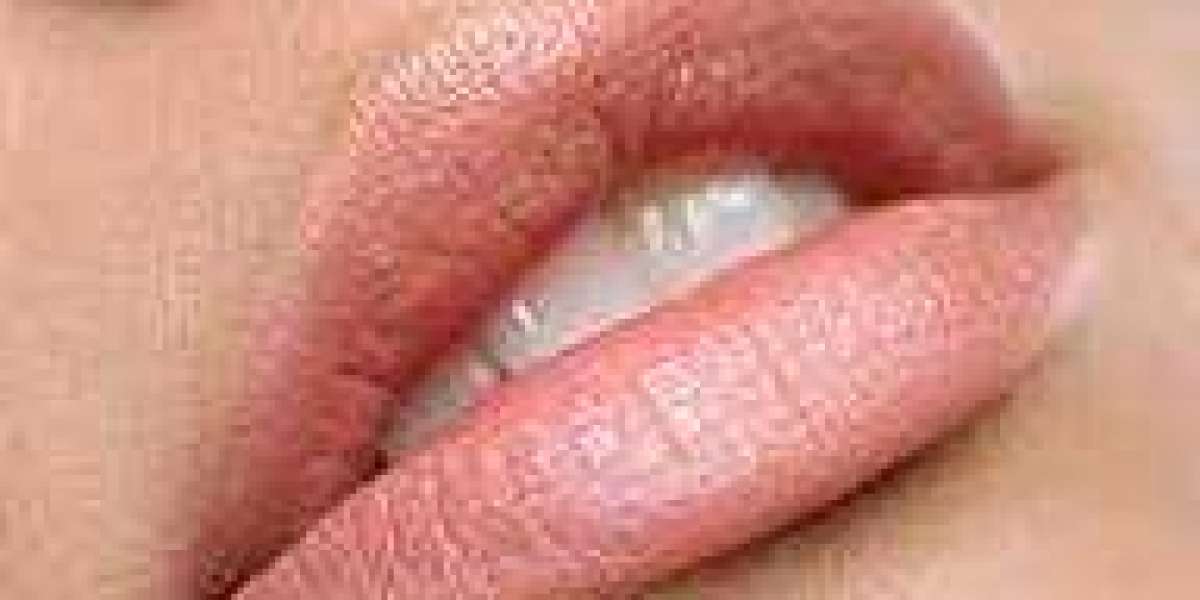 What Happens During a Lip Filler Procedure? Step-by-Step Guide