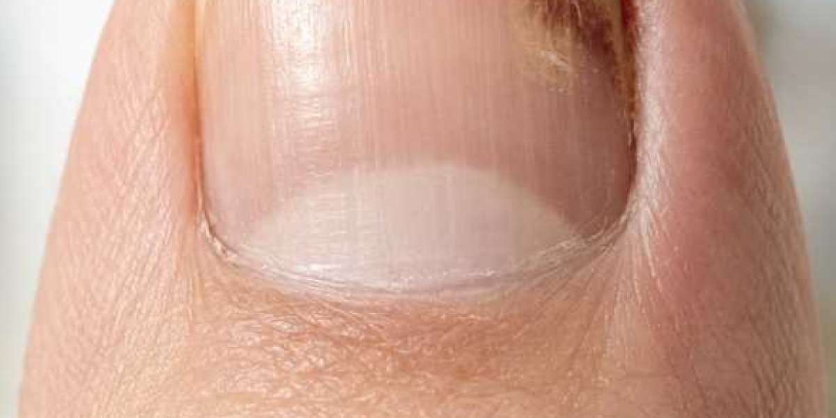 https://www.facebook.com/Foliaya.Anit.Fungal.Pen/